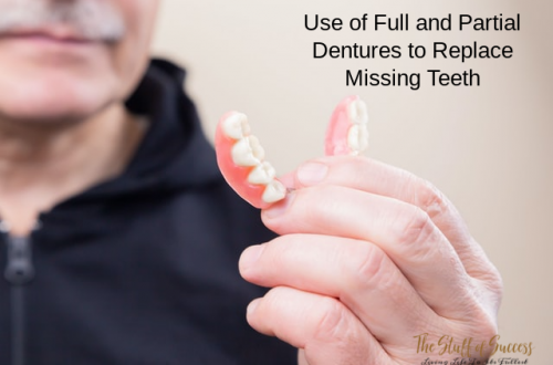 Use of Full and Partial Dentures to Replace Missing Teeth