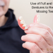 Use of Full and Partial Dentures to Replace Missing Teeth
