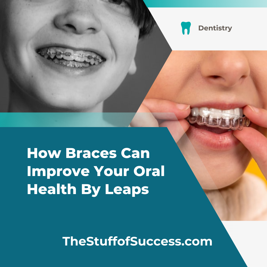How Braces Can Improve Your Oral Health By Leaps