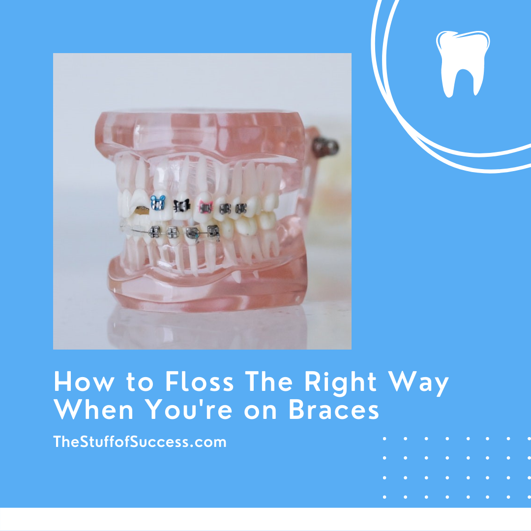 How to Floss The Right Way When You're on Braces