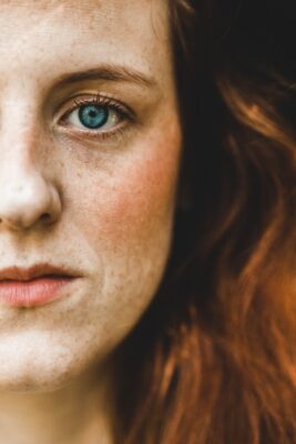 How Etrebelle 200mg Solves Skin Issues